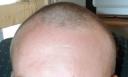 hairless